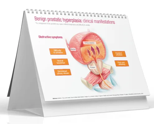 TABLE TOP FLIPCHART